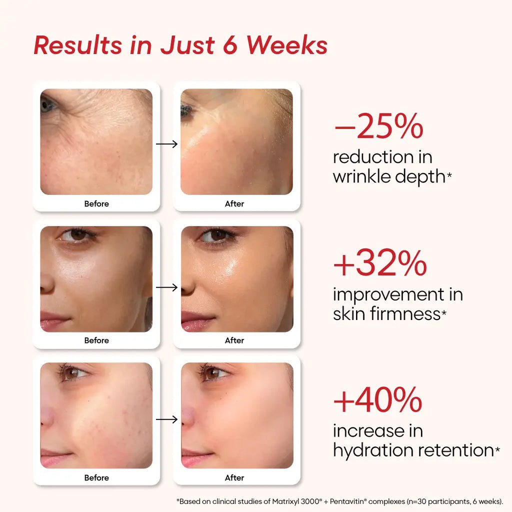 Renew Serum